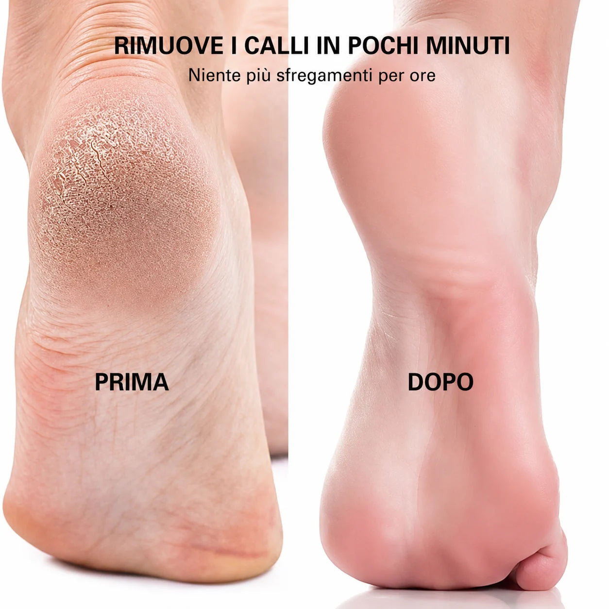 Pelluce Rimuovi Callosità per Piedi Ricaricabile