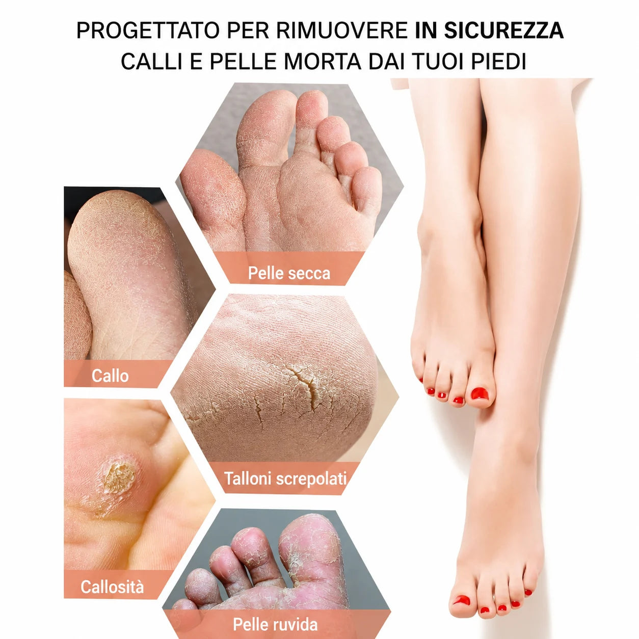 Pelluce Rimuovi Callosità per Piedi Ricaricabile